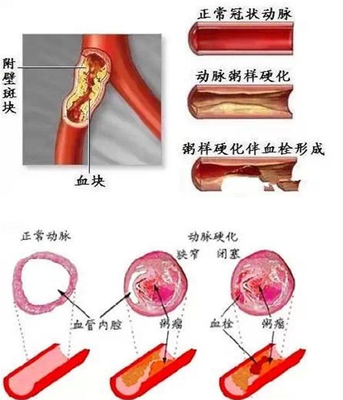 净水器租赁